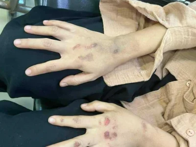 世道不平！缅甸仰光一名女子遭2名男子殴打抢钱