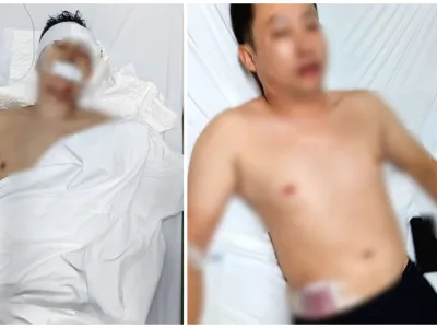 两名中国男子在工厂门口被人打成重伤