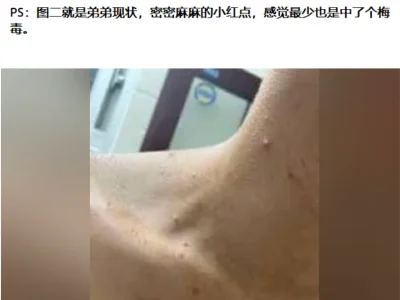 性病艾滋病已经成了东南亚电诈分子最大的生命威胁