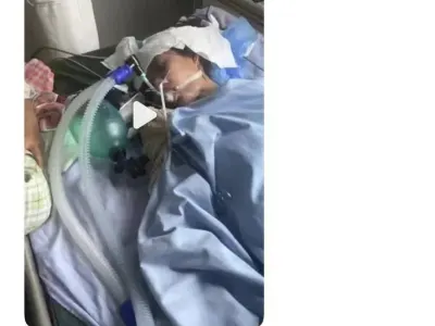 网友投稿：在菲小姐姐注射肉毒杆菌后并发症死亡