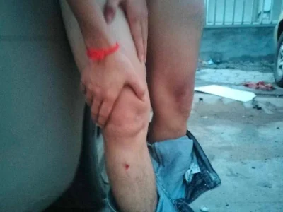 在赌场赢钱，金边一男子遭群殴？