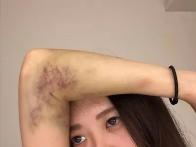 网友投稿 台湾精神小伙打女生