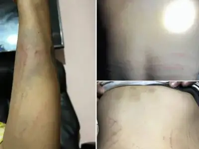 签合同时根本不知情，缅甸27岁女子应聘服务员被骗妓院 逃亡遭电线抽打砍头威胁