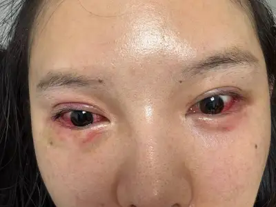 小姐姐投稿 我在一个公司正常上班，西港赢家的妈咪和客人老婆冲进来打我