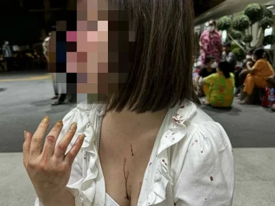柬籍女子遭围殴重伤，中国嫌犯：赔几百块，其他算了