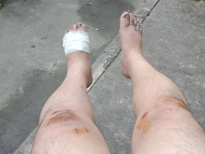 西港网友温馨提醒：在西岗海边有抢手机的！