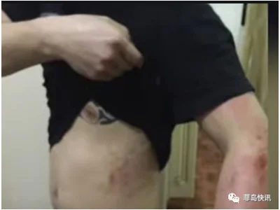 在菲惨遭公司老板绑架虐待，三中国人获救
