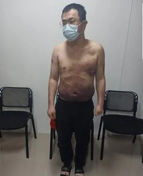 在菲遭绑架的台湾菜农已返台 所有积蓄被抢走 菲警特别关照