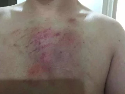 中国菜农遭遇仙人跳后被绑架勒索，.幕后之人竟然是中国同胞
