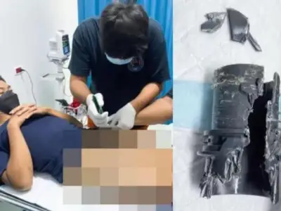 泰国“命根”被卡，竟是增大手术惹的祸 ！
