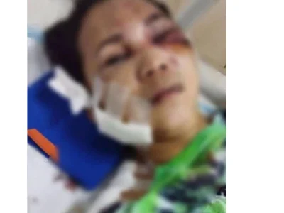 网络斗鸡害死人！菲律宾一单亲妈妈遭“吸毒赌博男”连捅10刀，生命垂危……