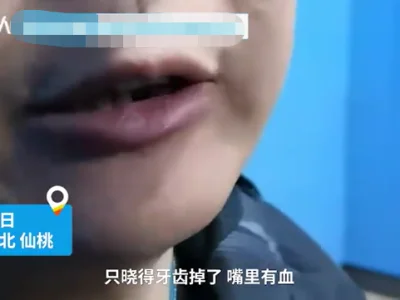 缅北回流男子血泪自述：跪铁笼 遭毒打 牙齿掉一颗 缺一颗 膝盖跪出疤痕