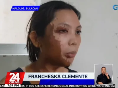 菲律宾布拉干省两姐妹返家途中被喷硫酸 脸部差点毁容
