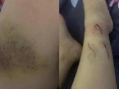 女子揭柬埔寨工作残酷真相：10个出去只有1个回来，台湾女生很好卖