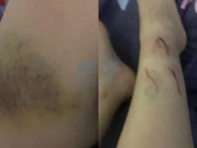 “台湾女生很好卖，10个出去可能只有1个回来！”台女揭海外高薪工作恐怖骗局