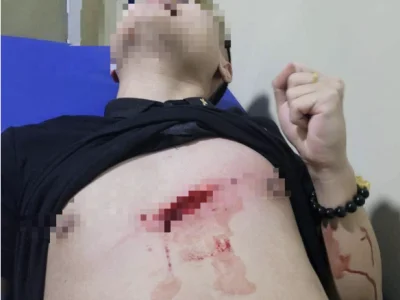 前晚波贝发生砍人事件