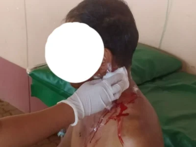 缅北腊戌发生持刀捅人案，刀身全部插进男子脖子内