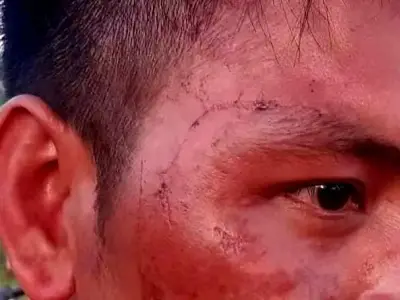 缅北一家武装在贵概镇殴打难民，2名难民被枪托砸伤