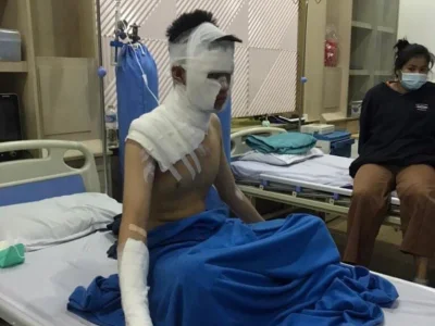 “电锅变炸弹”突然爆炸，老挝小伙在家熬药差点命都没了！