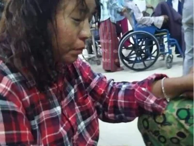 恐怖咯！曼德勒有歹徒泼硫酸抢摩托，一名30岁女性被毁容