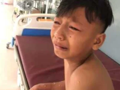 小心水母，9岁男孩被蜇伤