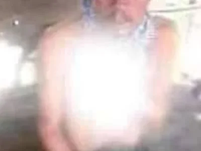 缅北南坎一小娃出生就被送进寺庙，现在1岁多了，遭泼猴撕咬手臂