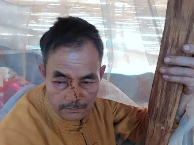 缅北腊戌一男子和老缅骂了一架，当晚遭追砍，脸上缝了13针