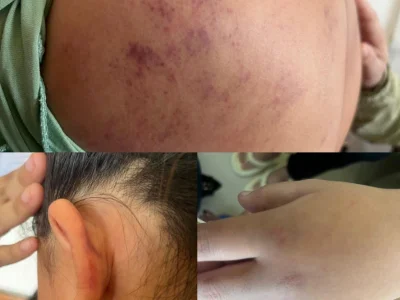 校园暴力太可怕！一名女生被一群同学脱光衣服、殴打两小时