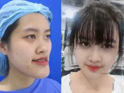 有人飞机上胸炸了，有人逆袭嫁入豪门，越南人造美女现状曝光