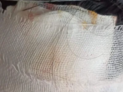 缅北腊戌一名18岁少女上街，遭歹徒追砍殴打，抢走摩托和手机