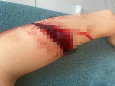 网友投稿：灌南18楼艾伦 之前跑车队的吸毒，认识这么久了，一直没想到竟然会被绑架