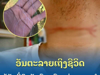 好可怕！老挝男子骑摩托车时，险被透明丝线割喉